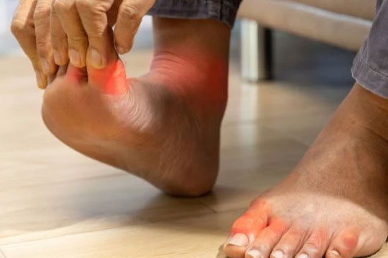 CANADI Clínica de Heridas y Pie Diabético en Hidalgo